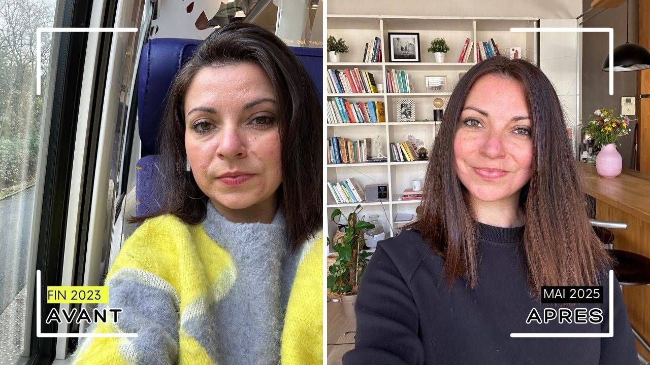 https://storage.tally.so/1316f690-125a-4e07-b987-5b42f2613f4b/Purple-and-Beige-Collage-Before-and-After-Beauty-Makeover-YouTube-Thumbnail-1-.jpg