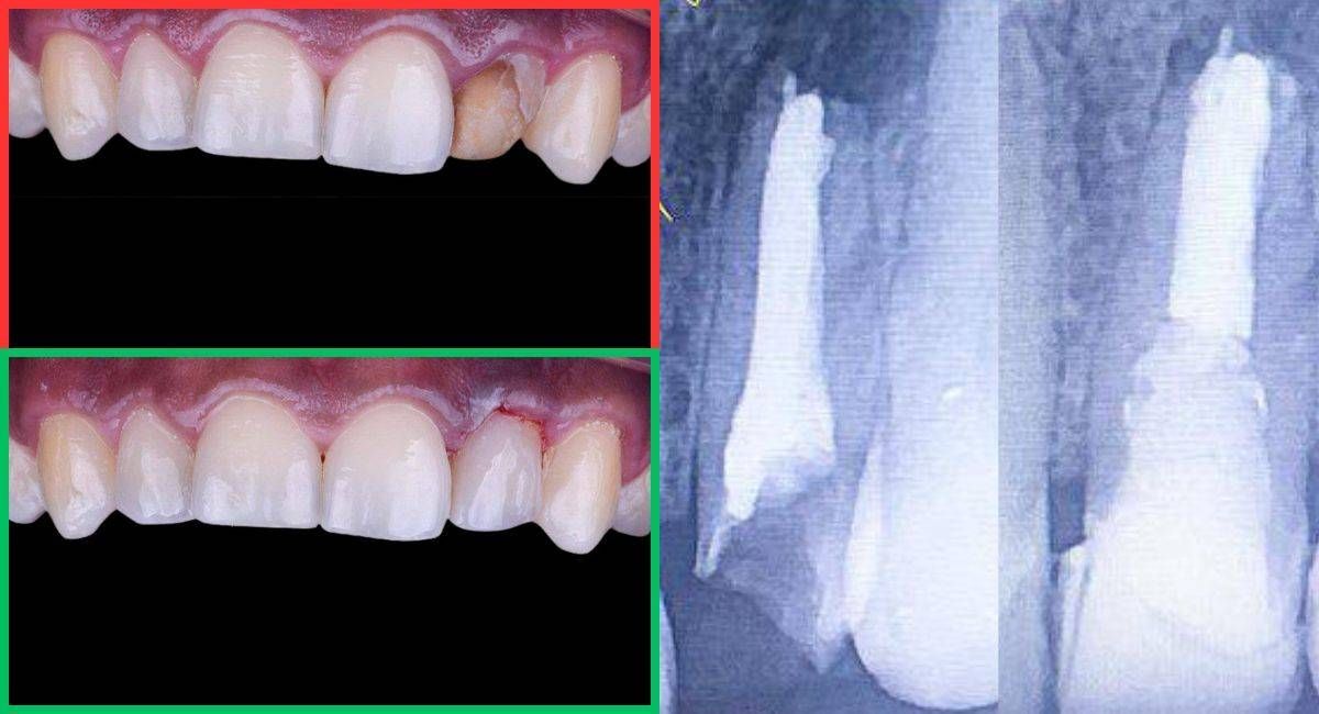 https://storage.tally.so/2853cb84-9353-4b7e-90ae-a8dea9201335/endodoncia.jpg