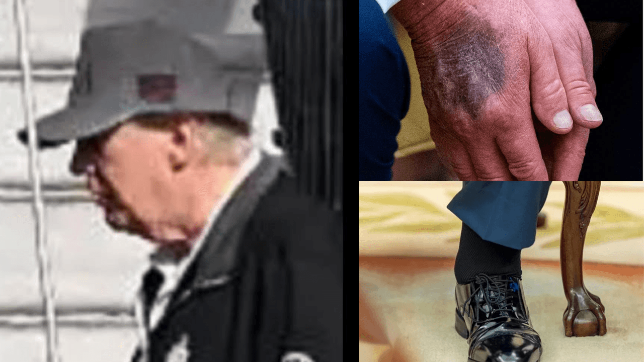https://storage.tally.so/2a458ca5-7a9e-4f90-9b8c-0f9f15961031/trump-health.png