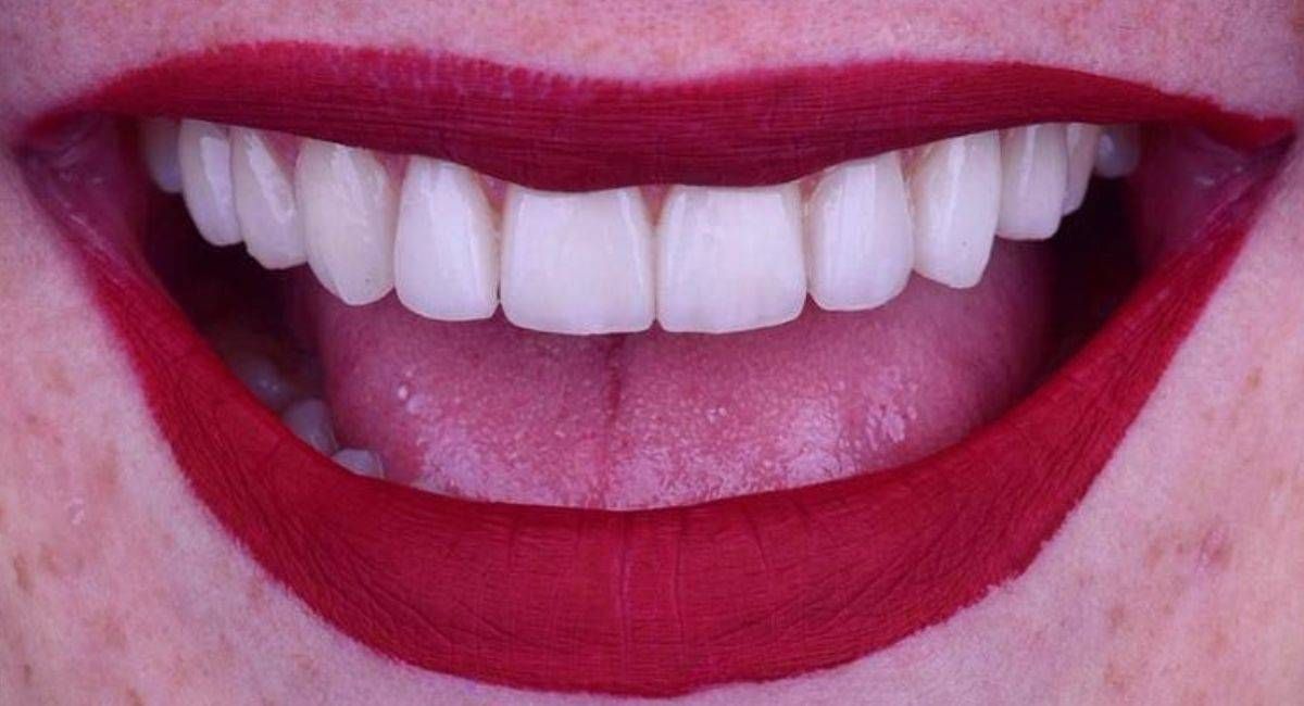 https://storage.tally.so/4fe7560e-7ed0-4acf-b6f1-a664b9d98550/sonrisa.jpg