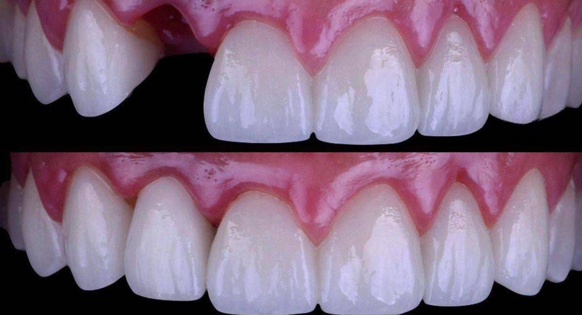 https://storage.tally.so/9f951a73-cb05-4846-b849-247a750a16b1/implantes.jpg
