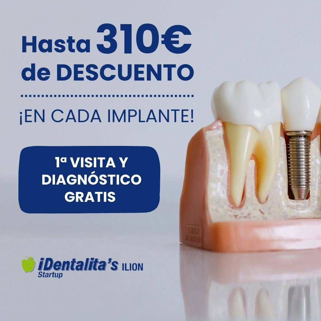 https://storage.tally.so/ce03bb46-22cc-48c9-9f4e-c571915d767b/3_IDENTALITAS_T1_IMPLANTE.jpg
